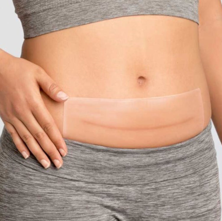 Mynd Amoena Silicone Squares, 2 stk/pk